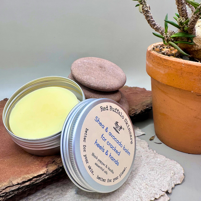 Heel rescue balm